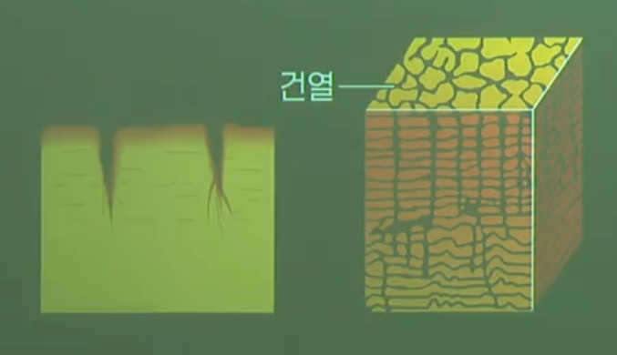 건열