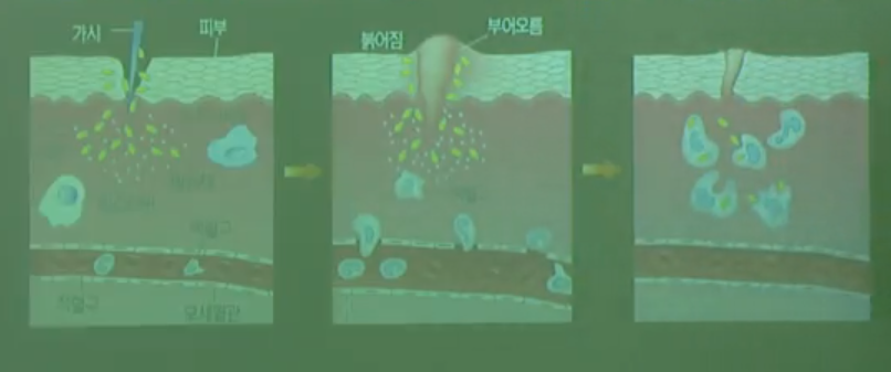식세포작용 식세포작용